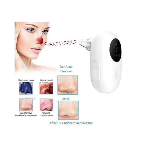 Aspirateur Anti Points Noirs  Cc9098
